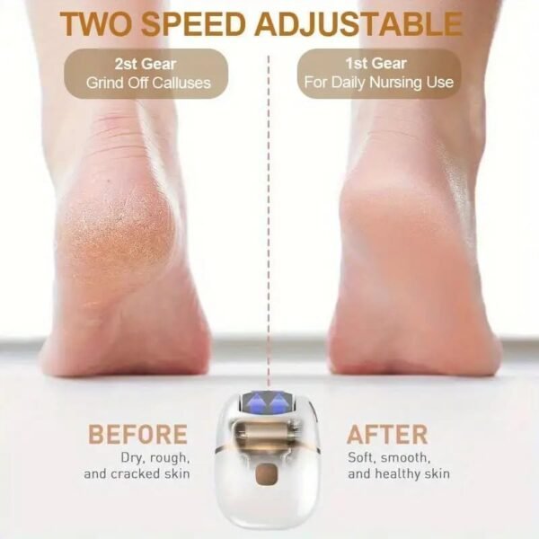 Heqës kallosh elektrik