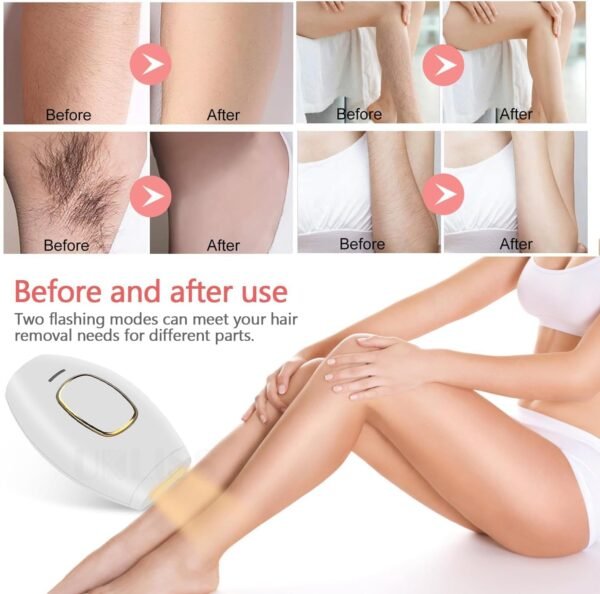 71Or3T9HBPL._AC_SL1500_ Lazer IPL